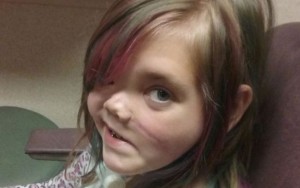Menina que teve crânio partido ao meio descreve "paraíso" após três anos em coma 